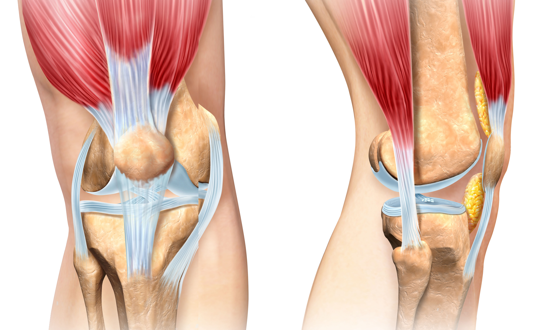 Patella Diz Kırığı 