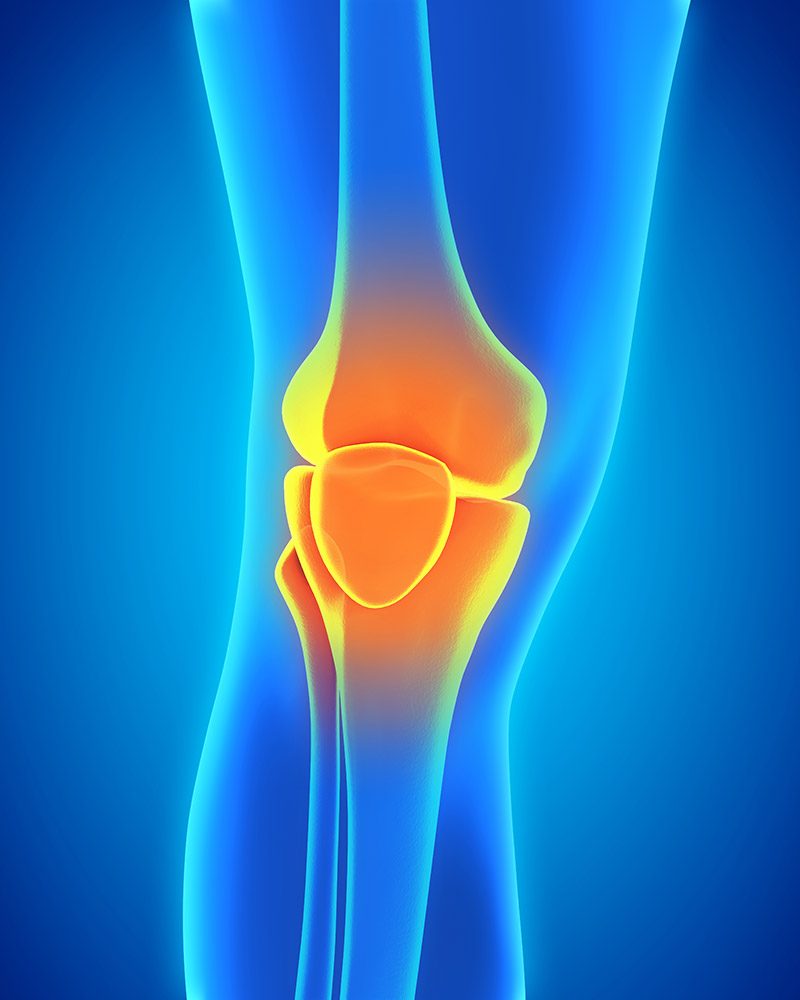 Patella Diz Kırığı