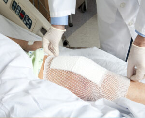 Kalça Protezi Ameliyatı Nasıl Yapılır