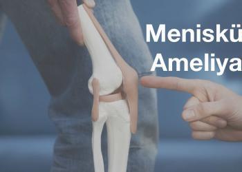 menisküs ameliyatı