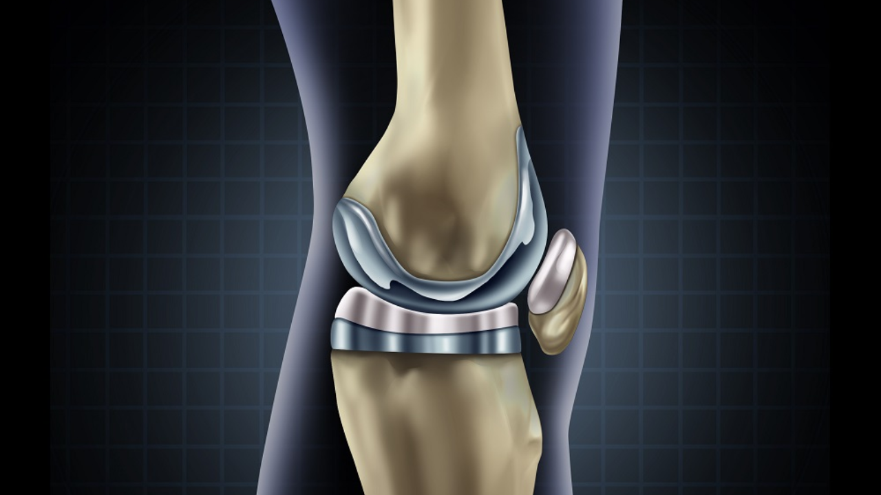 Diz Protezi Ameliyatı Sonrası Diz Protezi Ameliyatı Sonrasıb