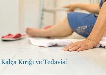 kalça kırığı ve tedavisi