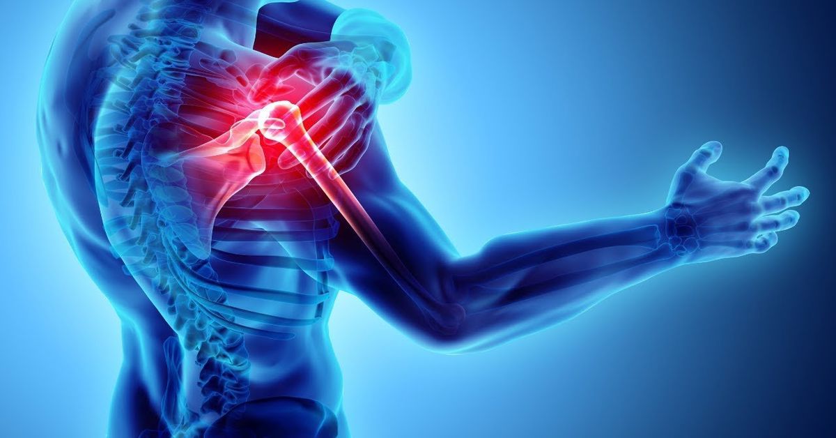 Omuz Kireçlenmesi Omuz Kireçlenmesi