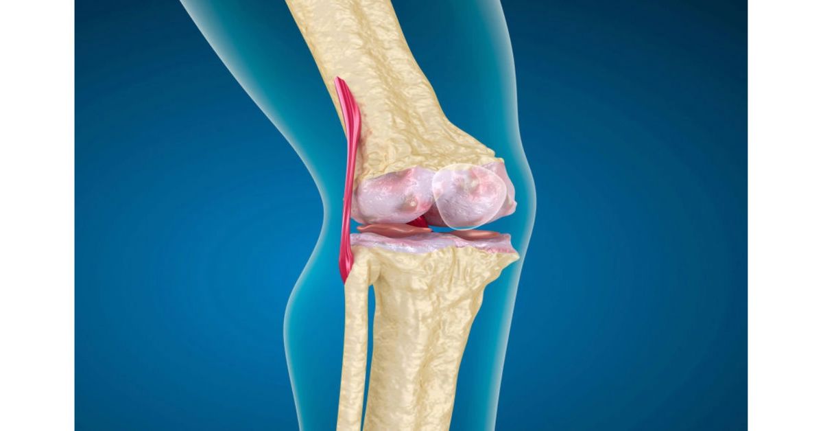 Kapalı Diz Ameliyatı Kapalı Diz Ameliyatı