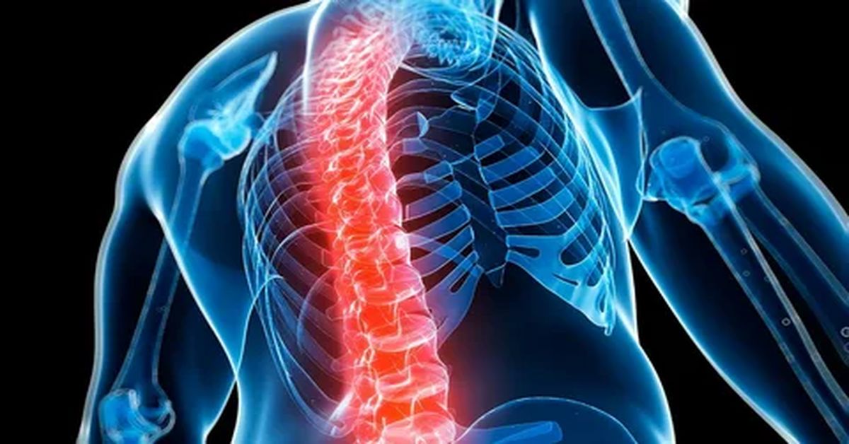 Kemik Erimesi Tedavisi Kemik Erimesi Tedavisi