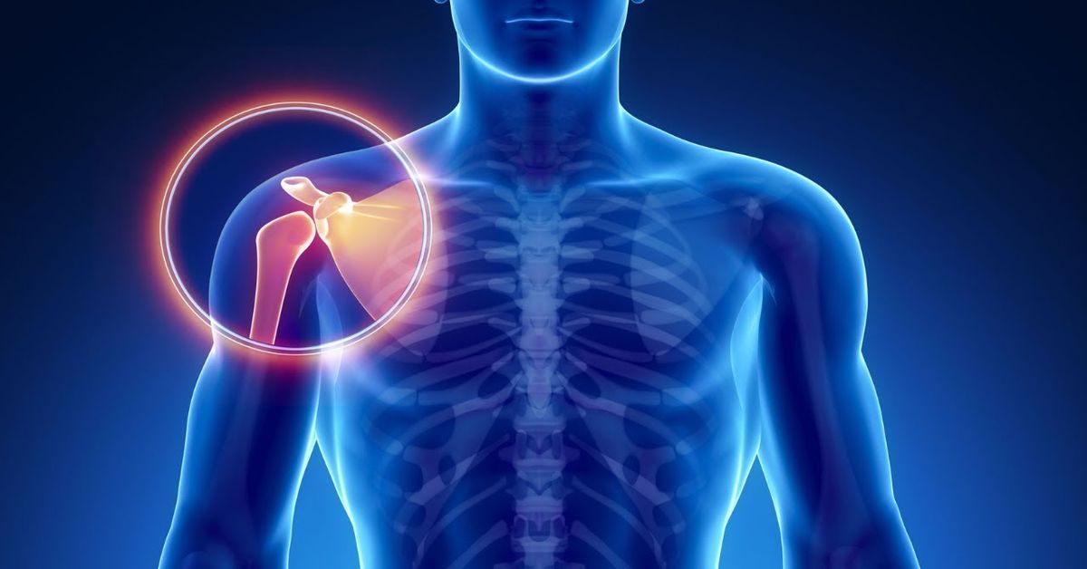 Omuz Çıkığı Belirtileri Omuz Çıkığı Belirtileri