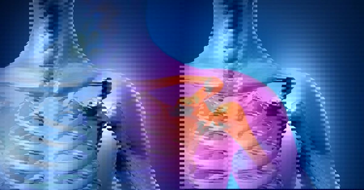 Omuz Çıkığı Belirtileri Omuz Çıkığı Belirtileri