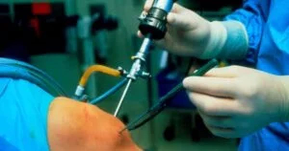 Artroskopik Cerrahi Nedir? Artroskopik Cerrahi Nedir?
