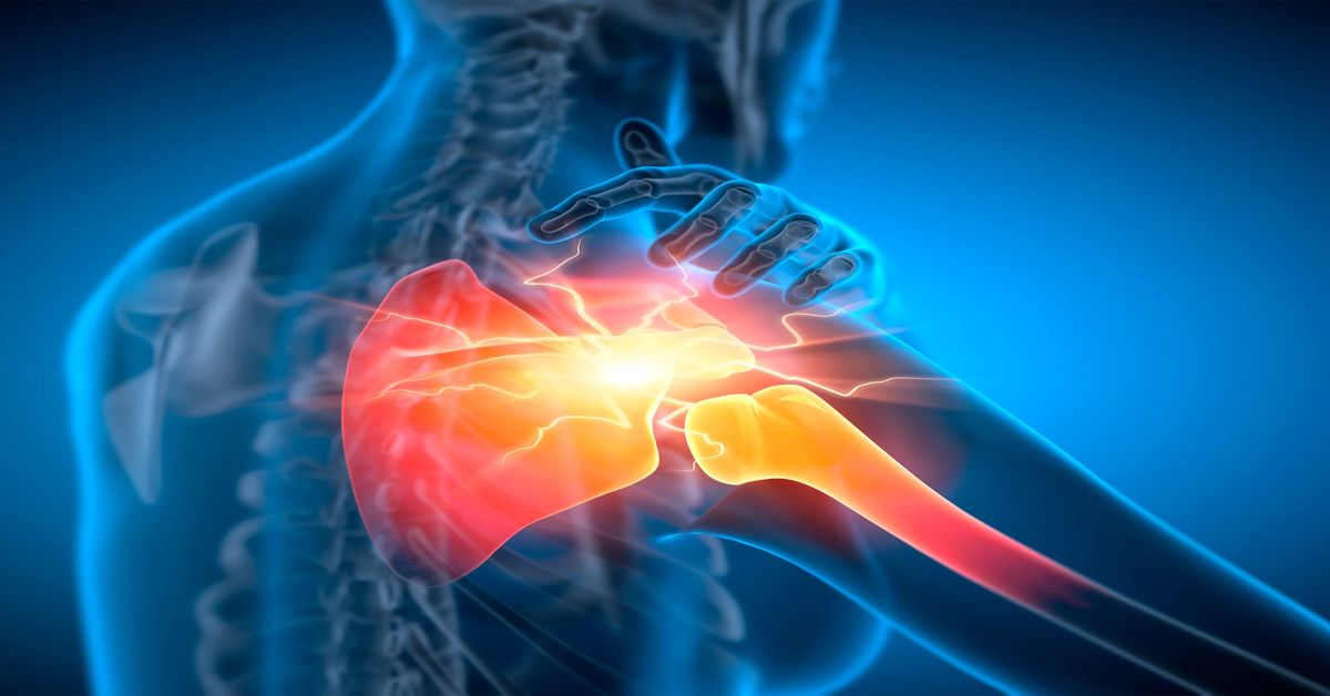Omuz Sıkışması Nedir? Omuz Sıkışması Nedir?