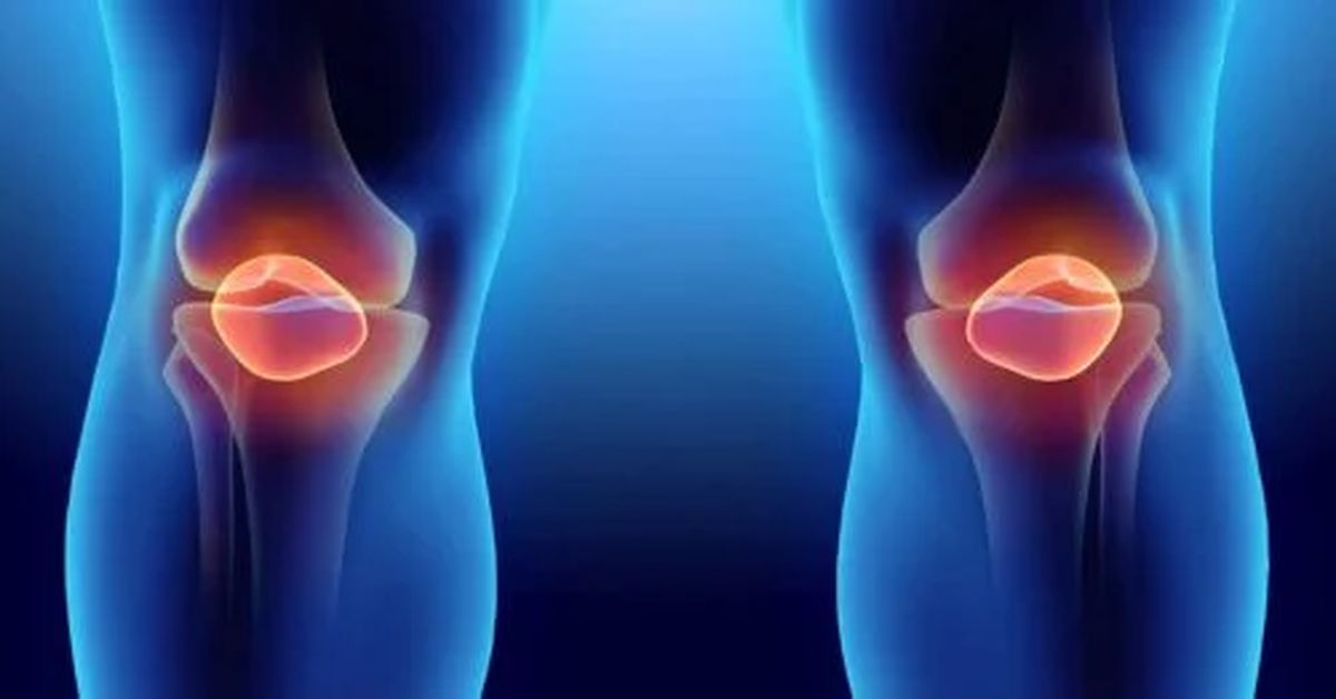 Menisküs Yırtılması Nedir? Menisküs Yırtılması Nedir?