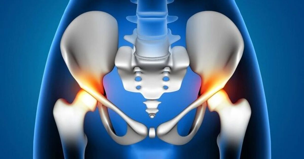 Yaşlılarda Kalça Kireçlenmesi Yaşlılarda Kalça Kireçlenmesi