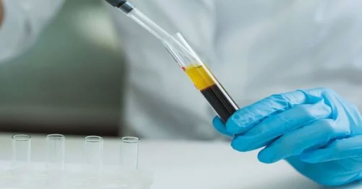 Plazma Tedavisi Nedir? Plazma Tedavisi Nedir?