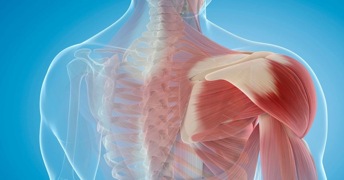 Kas Yırtığı Ameliyatı