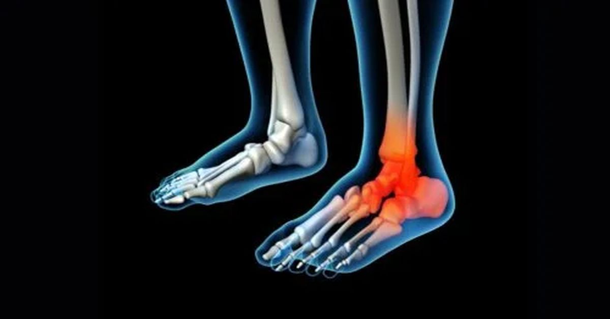 Tendon Kopması Tedavisi 