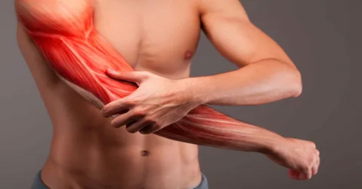 Kas Yırtığı Nedir? Kas Yırtığı Nedir?