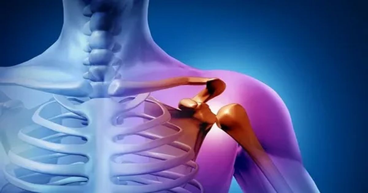 Omuz Sıkışması Tedavisi Omuz Sıkışması